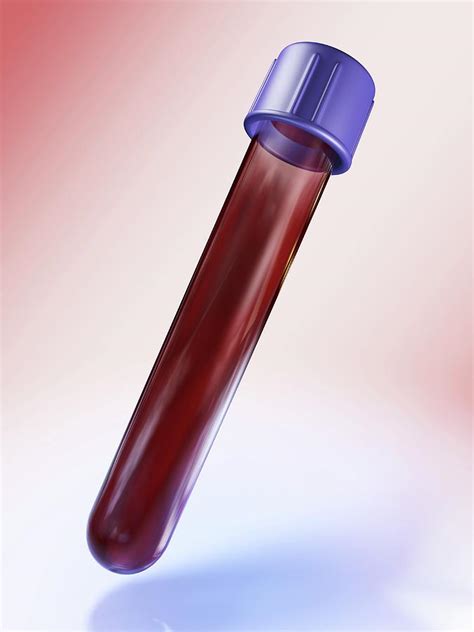 Medical Test Tube With Blood Photograph By Alfred Pasieka Science Photo