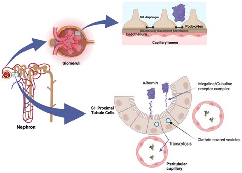 Albuminuria Silent Diabetic Nephropathy Kidney International