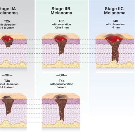 Overall Survival Of Metastatic Or Unresectable Melanoma From The Date Download Scientific