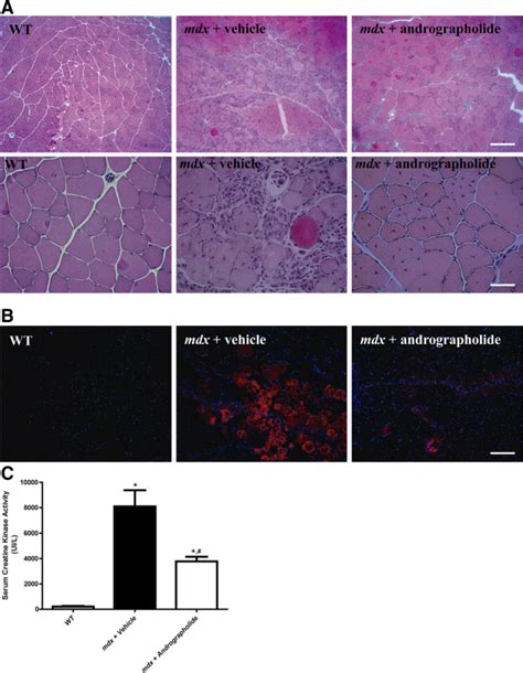 Andrographolide Reduces Skeletal Muscle Damage In Mdx Mice To Augment