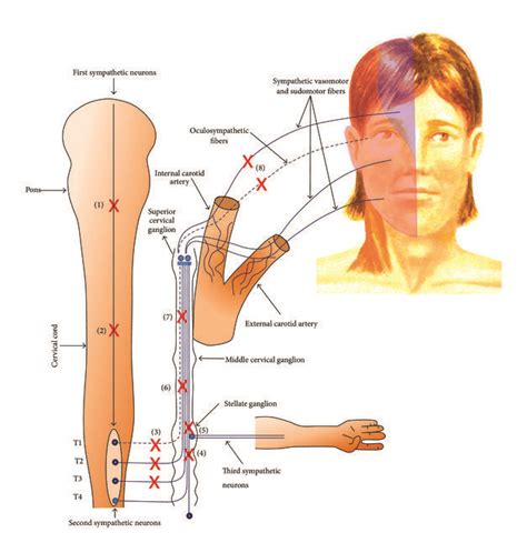 Diagram Demonstrating The Sympathetic Innervation To The Face With