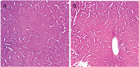 Histological Sections Of Rat Livers Treated In The Subacute