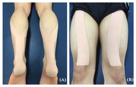 Ijerph Free Full Text Effects Of Double Taped Kinesio Taping On