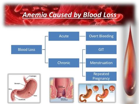 Anemia Causes