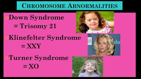 CHROMOSOME ABNORMALITIES presented by Psychology Professor Bruce ...