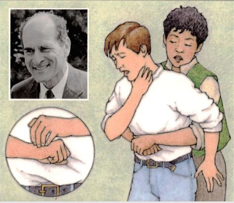 Dr Henry Heimlich’s Long Battle With The Red Cross Over His Namesake Maneuver Mental Floss