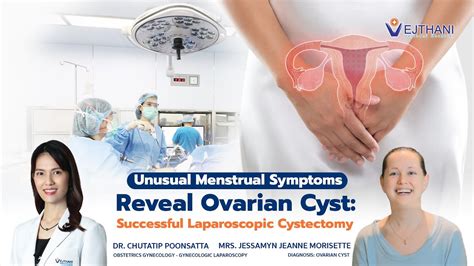 Unusual Menstrual Symptoms Reveal Ovarian Cyst Successful Laparoscopic