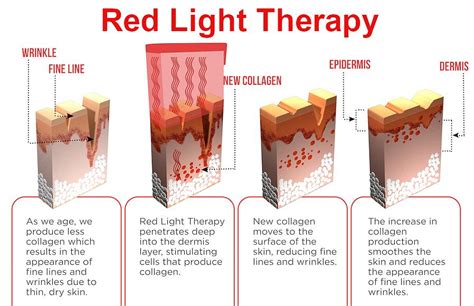 Como Usar A Terapia Da Luz Vermelha