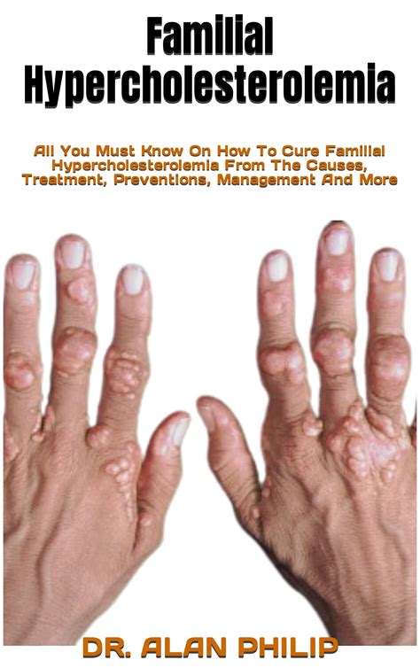 Familial Hypercholesterolemia All You Must Know On How To Cure