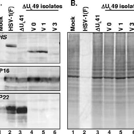 Vhs Accumulation And Shutoff Of Protein Synthesis In Vero Cells