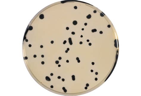 Tsc Tryptose Sulfite Cycloserine Agar Base