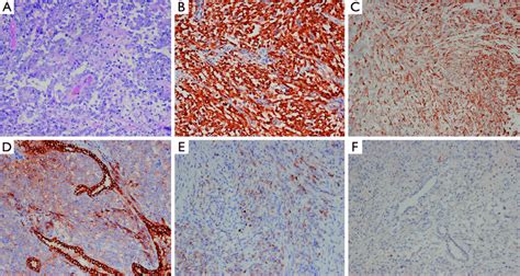 Hematoxylin And Eosin Staining He And Immunohistochemistry Ihc A