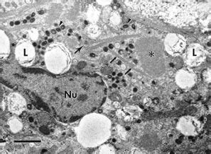 Transmission Electron Micrograph TEM Of Lung Note Naked Viroplasm