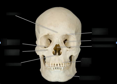 Ch.7 Axial: Skull Bone Markings Diagram | Quizlet