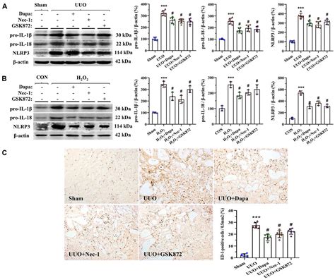 Frontiers Dapagliflozin Alleviates Renal Fibrosis By Inhibiting Rip1