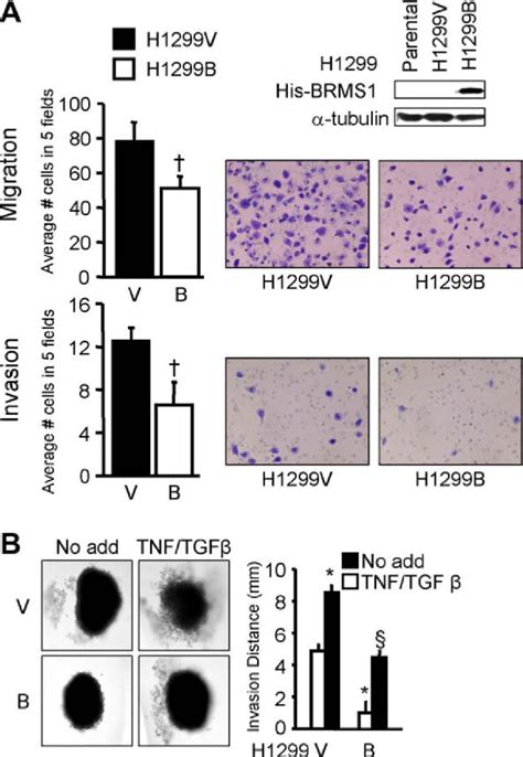 Figure 1 From Breast Cancer Metastasis Suppressor 1 Brms1 Suppresses