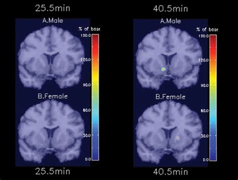 brain-imaging-improves-understanding-of-cigarette-addiction | RSNA