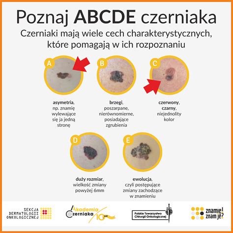 ABCDE Czerniak Gmina Konopnica