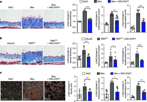 Treatment With Nsc Ameliorates Experimental Fibrosis The