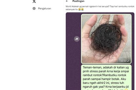 Foto Benarkah Stres Bisa Menyebabkan Rambut Rontok Ini Penjelasan Dokter