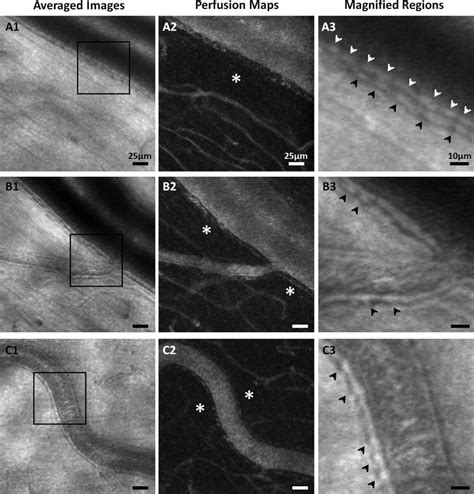 Longitudinal Cross Section Of Retinal Arterioles With Lumen Diameters Download Scientific