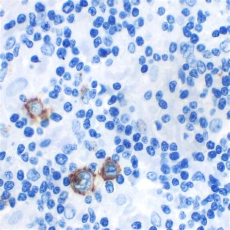 cd bra  pathnsitu biotechnologies