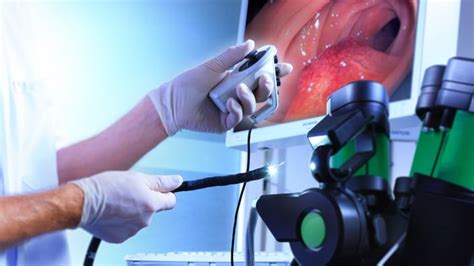 Saiba mais sobre a endoscopia para que serve e como é feito o exame