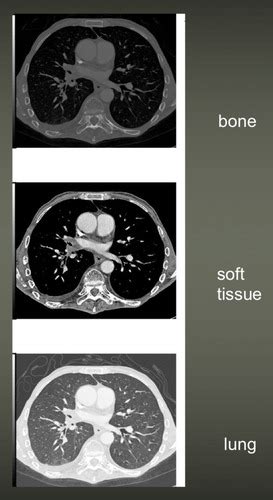 DI Lecture 5 Digital Radiography Flashcards Quizlet