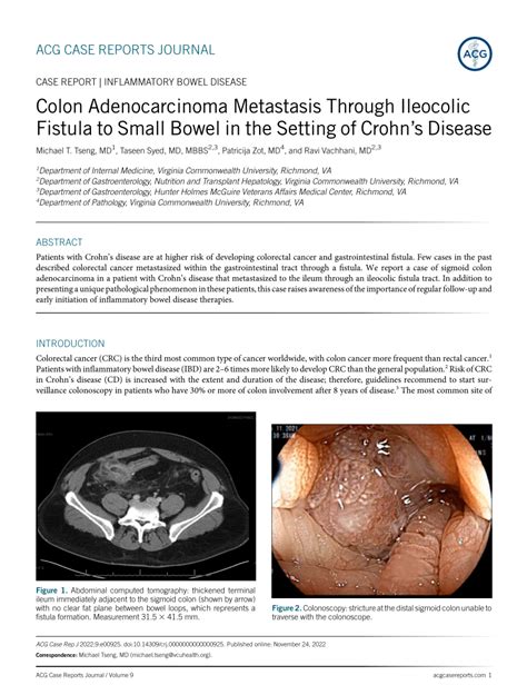 Pdf Colon Adenocarcinoma Metastasis Through Ileocolic Fistula To Small Bowel In The Setting Of