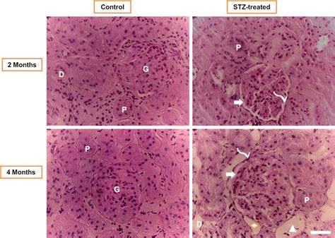 Glomerular Basement Membrane Representative Light Micrographs Of