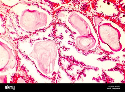 Gl Ndula Prost Tica Histolog A Banque De Photographies Et Dimages