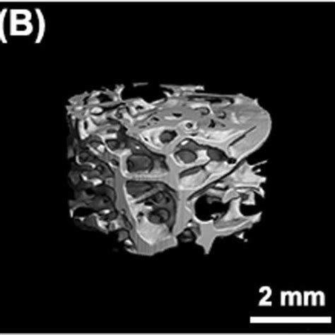 The D Micro Ct Images Of New Bone Tissue At Months A Months B