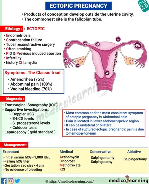 Ectopic Pregnancy – MedicoLearning 