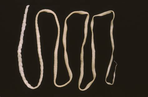 Man Gets Fatal Cancer From His Own Tapeworm