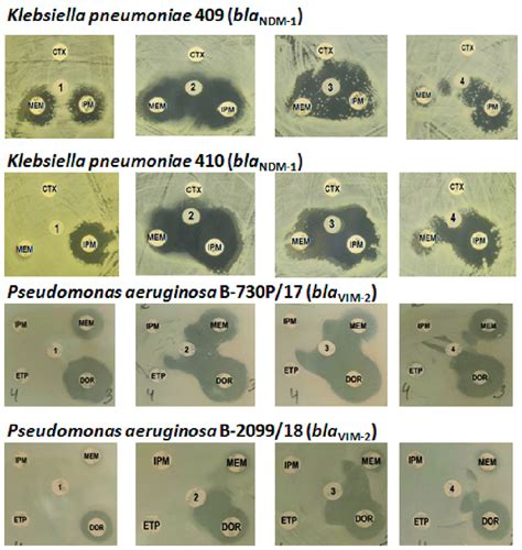 Phenotypic detection of metallo β lactamases NDM 1 and VIM 2 inhibition