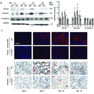 IL 18 Deletion Suppressed Tubular Cell Transdifferentiation At Day 14