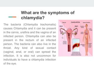 Chlamydia infections | PPT | Free Download