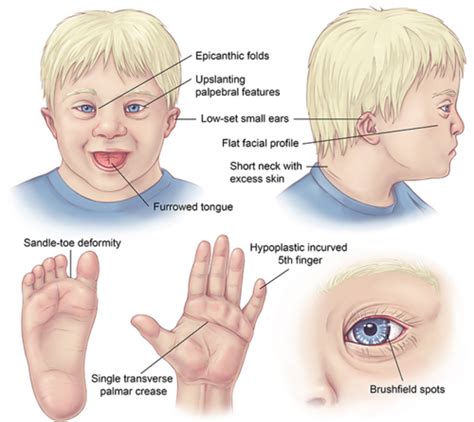 Congenital Anomalies Flashcards Quizlet