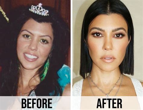 Kourtney Kardashian Doesnt Even Look Like Herself Anymore—her Face Has