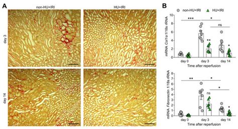 Cells Free Full Text Asymptomatic Hyperuricemia Promotes Recovery