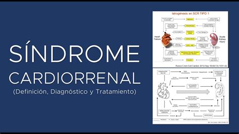 Síndrome Cardiorrenal Definición Fisiopatología Diagnóstico y