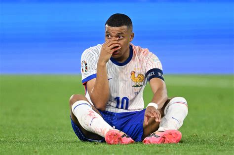 Mbappe Suffers Broken Nose During France Win Public Radio Of Armenia