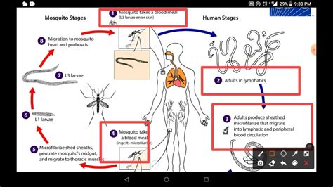 Filaria Life Cycle How To Lymphatic Filariasis Spread Youtube