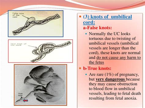 Ppt Fetal Membranes Powerpoint Presentation Free Download Id2278096