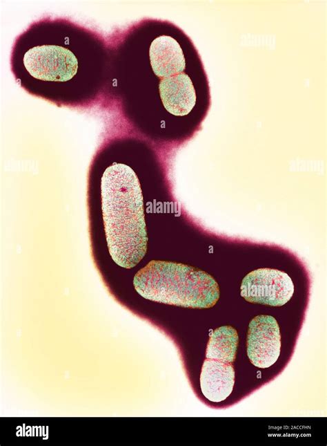 E Coli Bacteria Coloured Transmission Electron Micrograph Tem Of A