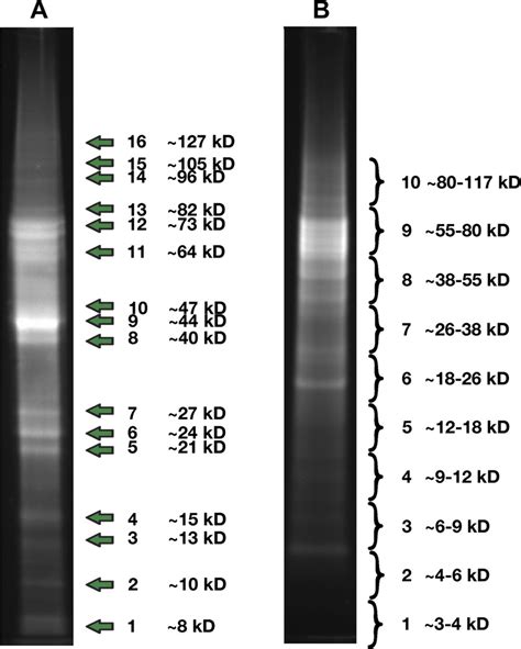 Denaturing Polyacrylamide Gel Electrophoresis Of Protein Extracts Download Scientific Diagram