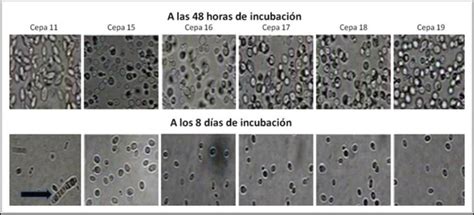 Cultivos De Levaduras Puestos A Crecer En Medio RAT Y Observados Al