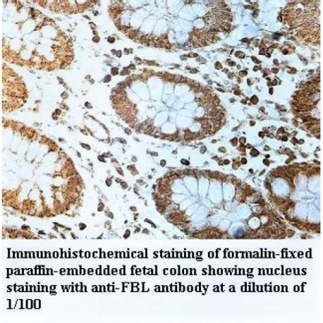 fbl antibody supplier cas aobious
