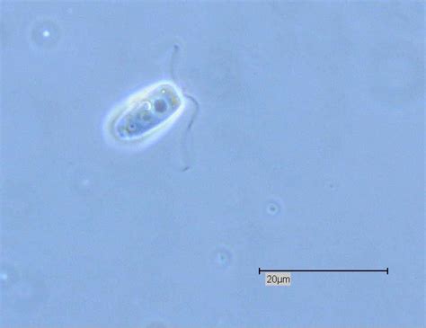 Naegleria Fowleri Flagellate