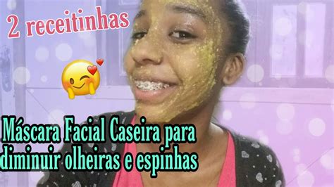 Máscara Facial Caseira para diminuir olheiras e espinhas coisas que